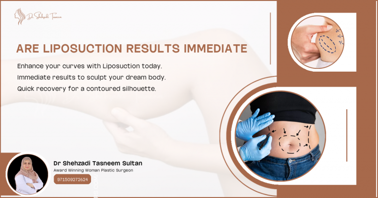 Are Liposuction Results Immediate