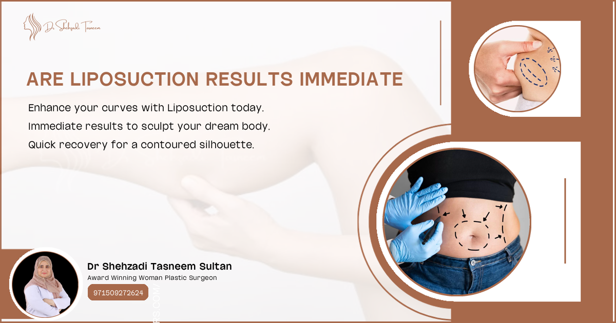 Are Liposuction Results Immediate | 2024