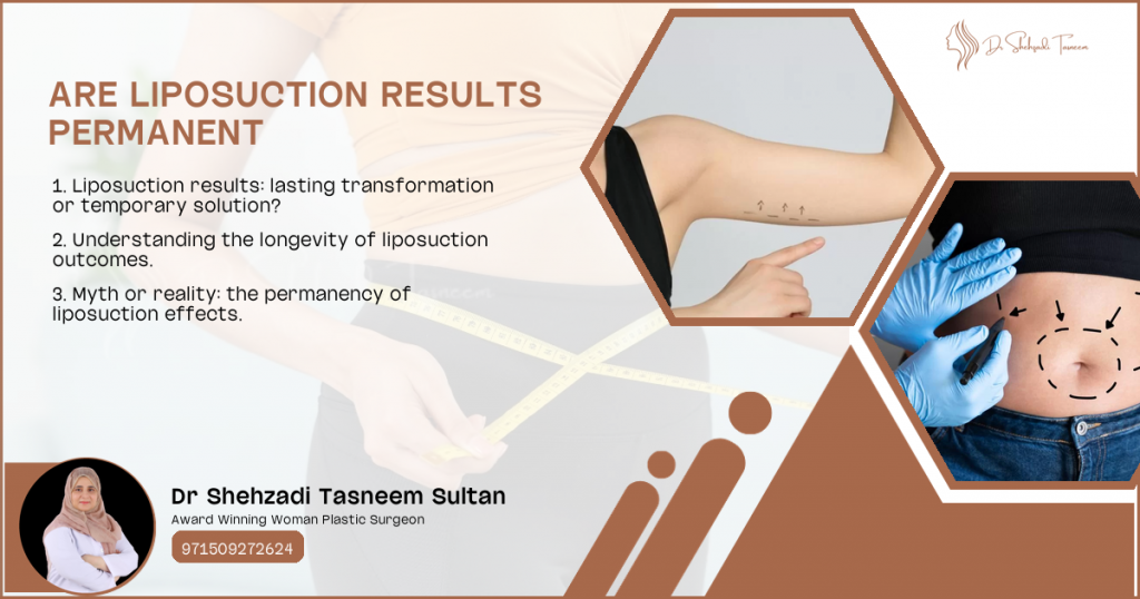 Are Liposuction Results Permanent | Best Female Plastic Surgeon In ...