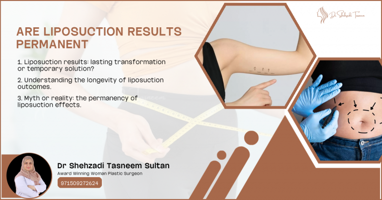 Are Liposuction Results Permanent