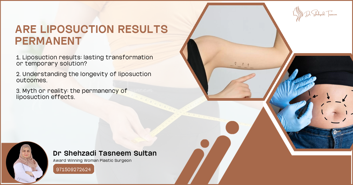 Are Liposuction Results Permanent | 2024