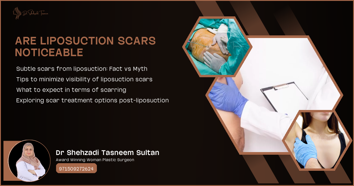 Are Liposuction Scars Noticeable | 2024