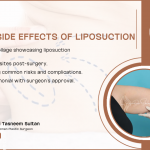 Are There Side Effects Of Liposuction | 2024