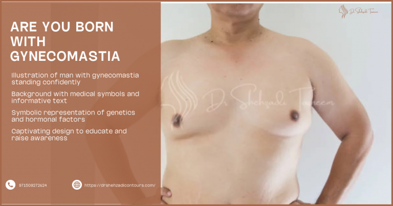 Are You Born With Gynecomastia