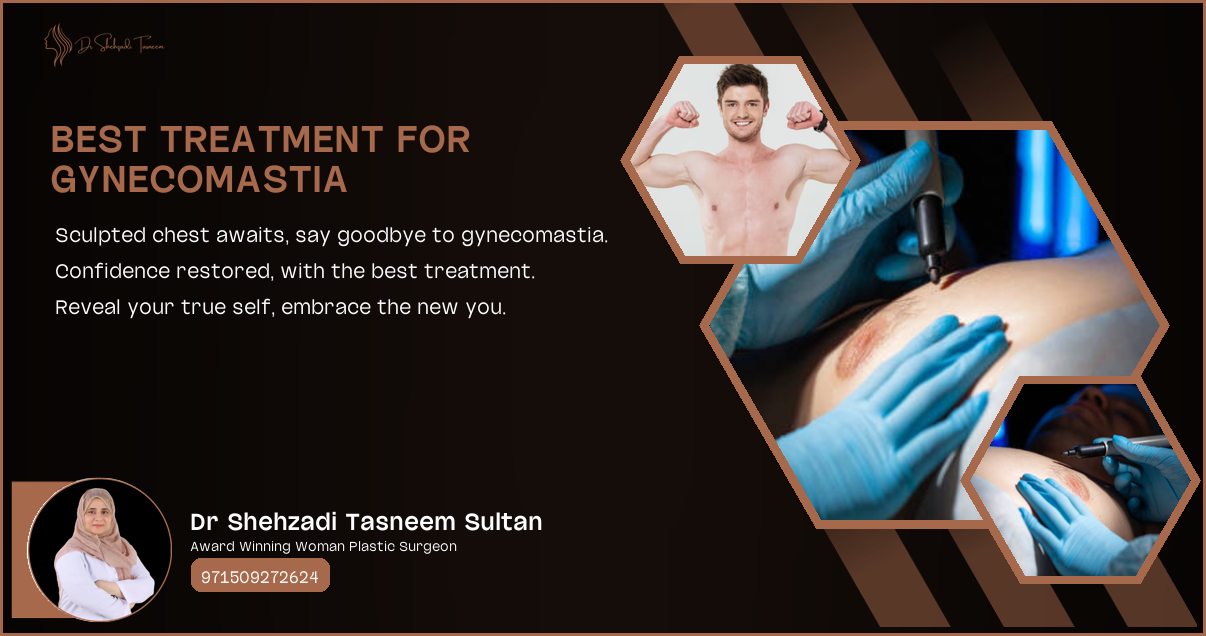 Best Treatment For Gynecomastia | 2024